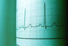 social media id trace node